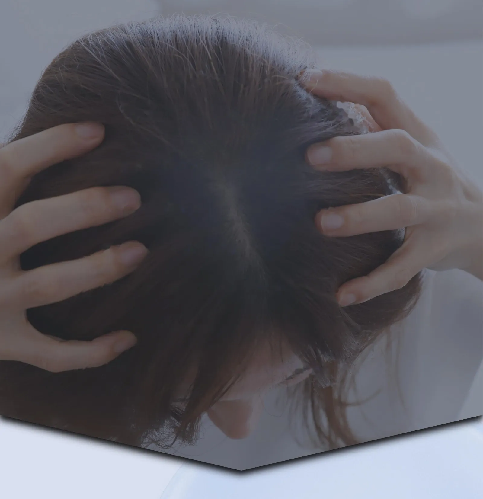両手で頭を抱え、頭皮を気にする女性